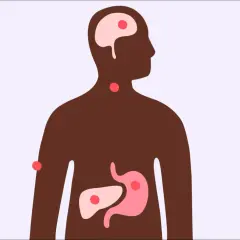 Illustration av en mänsklig silhuett med markerade organ som hjärna, hals, mage och lever. Röd prickar indikerar punkter av intresse. Denna bild kan illustrera vad innehåller te för kroppen.