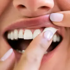 En person drar upp läppen och visar tänderna, en känsla av snus ångest.