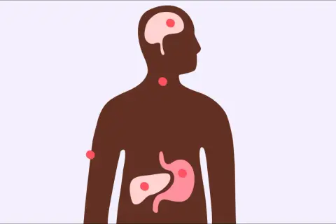 Illustration av en mänsklig silhuett med markerade organ som hjärna, hals, mage och lever. Röd prickar indikerar punkter av intresse. Denna bild kan illustrera vad innehåller te för kroppen.