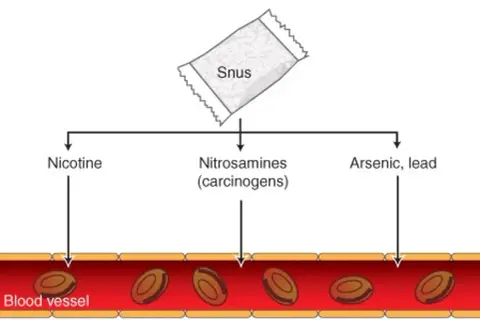 Diagram visar hur snus avger nikotin, nitrosaminer och arsenik/bly som tas upp i blodkärl.