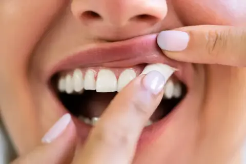En person drar upp läppen och visar tänderna, en känsla av snus ångest.