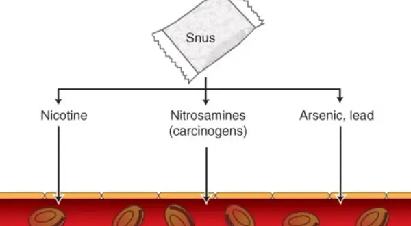 Diagram visar hur snus avger nikotin, nitrosaminer och arsenik/bly som tas upp i blodkärl.