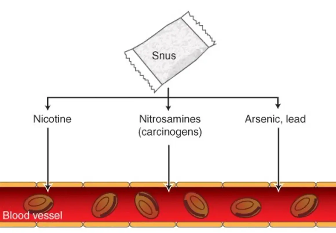 Diagram visar hur snus avger nikotin, nitrosaminer och arsenik/bly som tas upp i blodkärl.