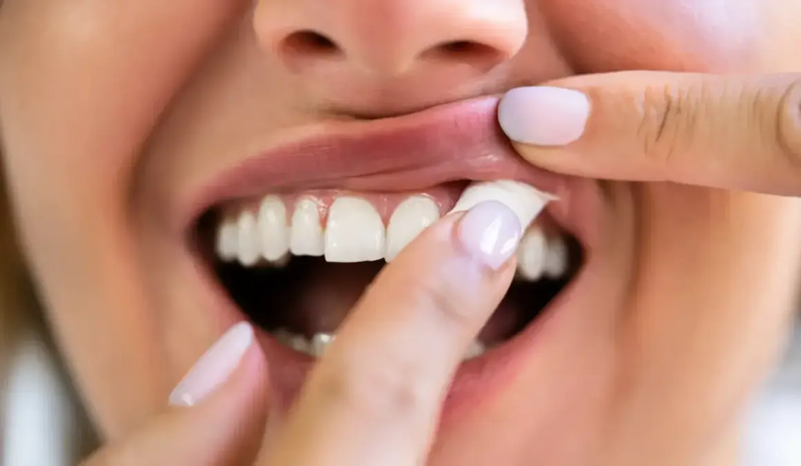 En person drar upp läppen och visar tänderna, en känsla av snus ångest.