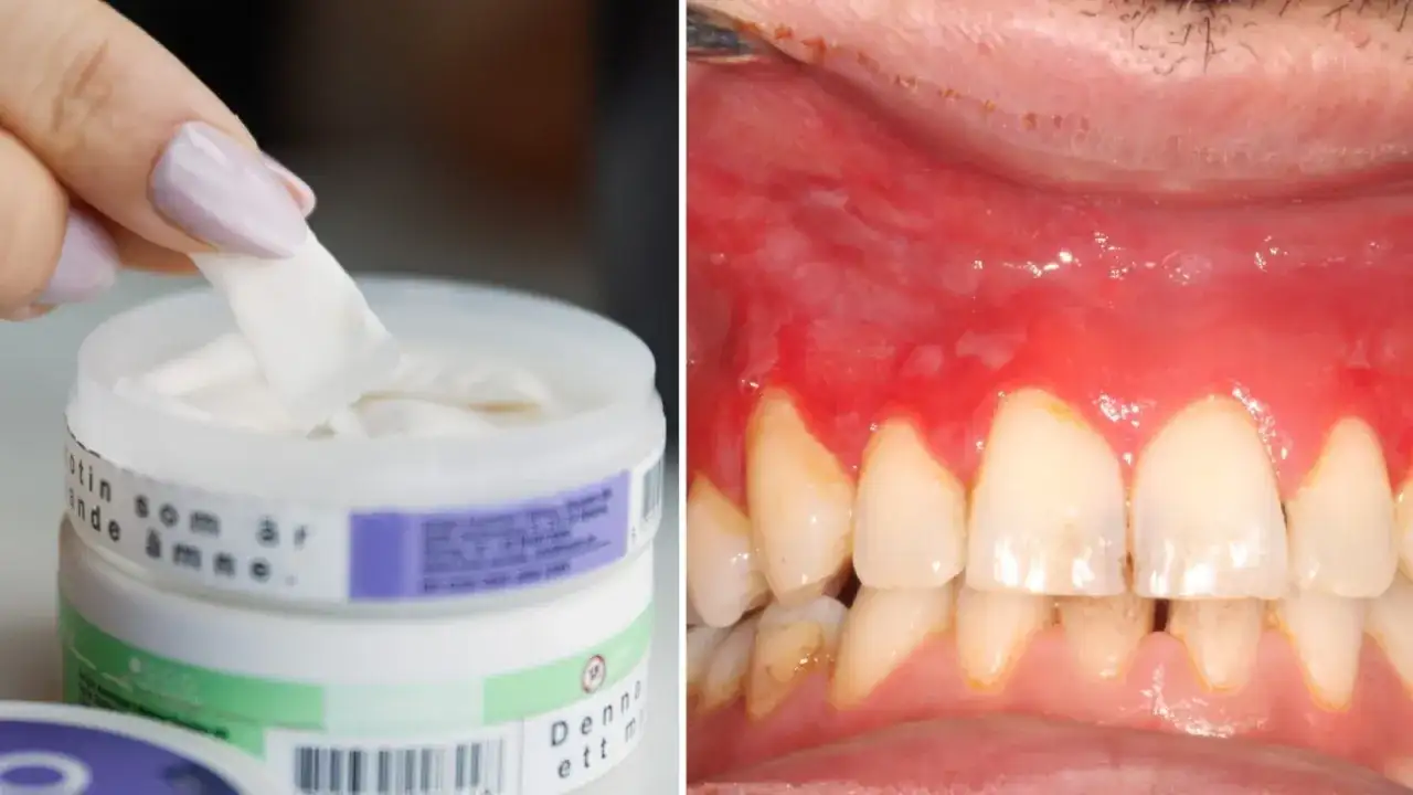 Problem med Granit-snus? Symtom, styrka och återkallelse