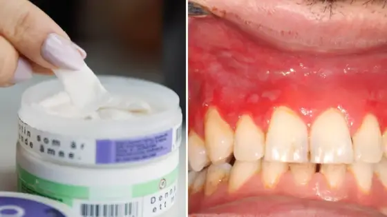 Problem med Granit-snus? Symtom, styrka och återkallelse